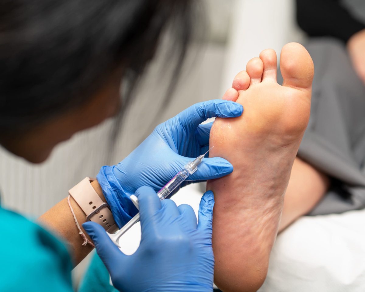 Fat Grafting for Foot Pain Relief: Understanding Fat Pad Atrophy